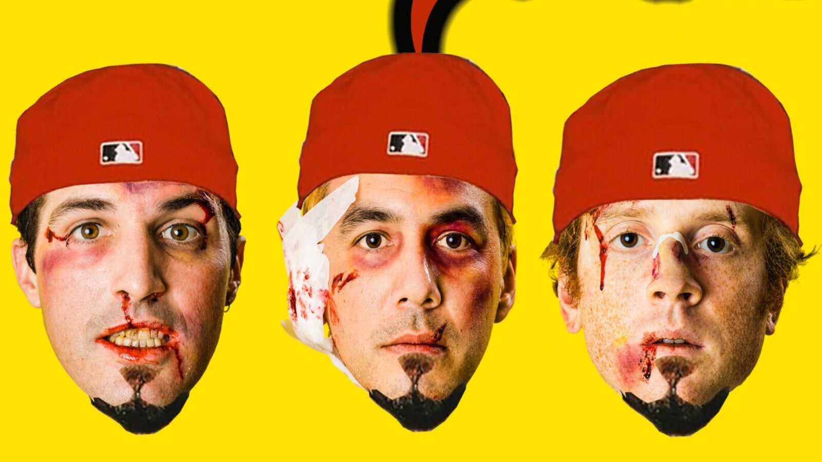 Hear surf-punk band FIDLAR cover LIMP BIZKIT’s “Nookie”