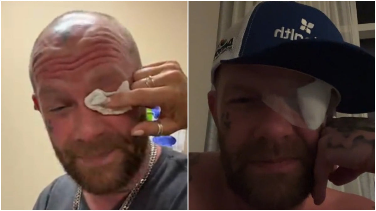 Five Finger Death Punch’s Ivan Moody Injures Eye From Laser Blast