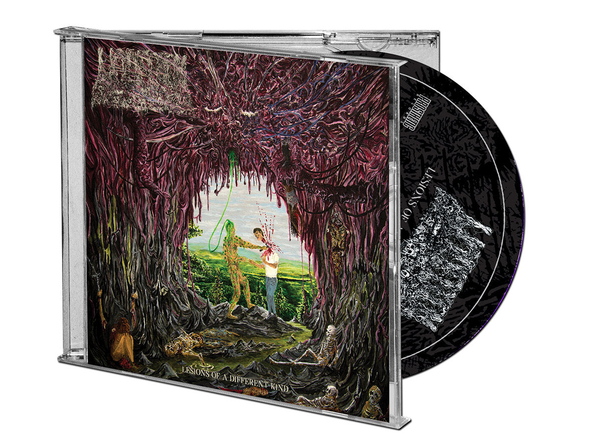 UNDEATH 'LESIONS OF A DIFFERENT KIND' CD