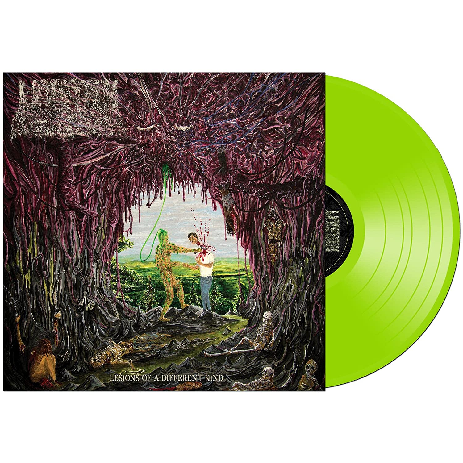 UNDEATH 'LESIONS OF A DIFFERENT KIND' LP (Green Vinyl)