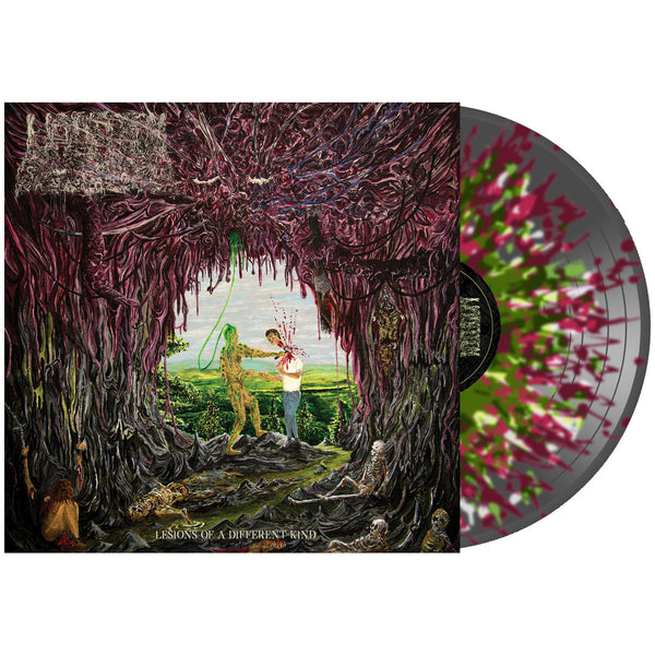 UNDEATH 'LESIONS OF A DIFFERENT KIND' LP (Clear Black w/Maroon, Green, & White Splatter Vinyl)
