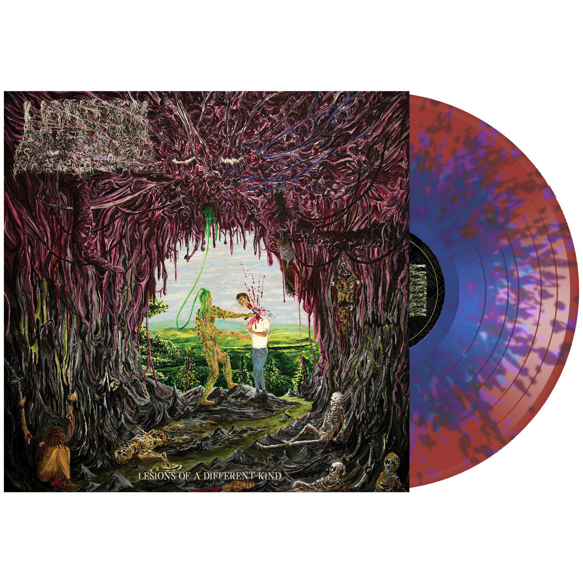 UNDEATH 'LESIONS OF A DIFFERENT KIND' LP (Clear Dark Red w/ Light Blue Splatter Vinyl)